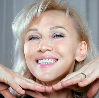 Immagine di una donna dopo 28 giorni di trattamento Retilift